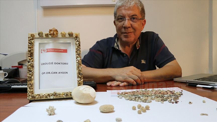 Üroloji doktoru hastalarından aldığı 'taşlar'dan koleksiyon yaptı